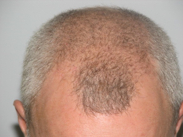 Click image for larger version
Name: 3500g pre op FHL.JPG
Size: 78.8 KB
ID: 11419