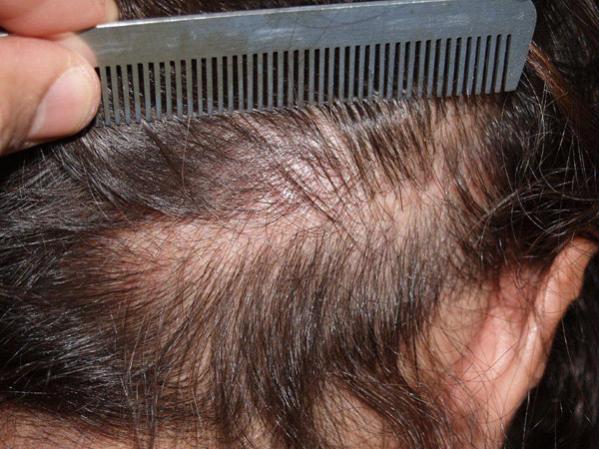 Click image for larger version

Name:	leonardoa-scar-repair0.jpg

Size:	55.3 KB
ID:	1658