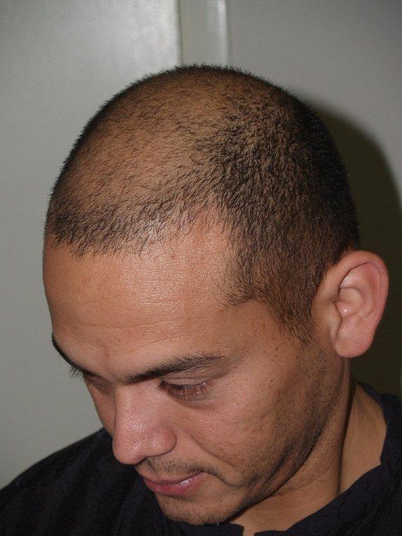 Click image for larger version

Name:	samvelazquez bef aft02.jpg

Size:	64.2 KB
ID:	2080