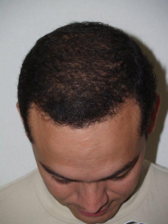 Click image for larger version

Name:	samvelazquez bef aft08.jpg

Size:	63.6 KB
ID:	2086