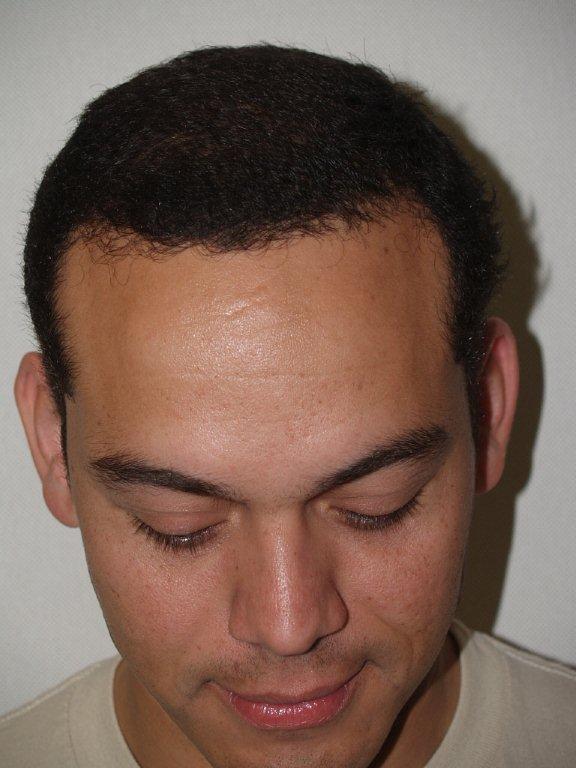 Click image for larger version

Name:	samvelazquez bef aft09.jpg

Size:	61.5 KB
ID:	2087