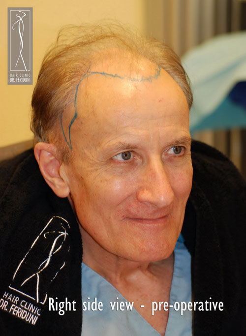 Click image for larger version
Name: DSC_0878.jpg
Size: 58.5 KB
ID: 213