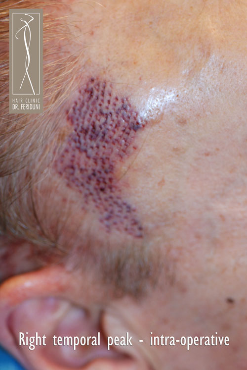 Click image for larger version
Name: DSC_0887.jpg
Size: 63.5 KB
ID: 217