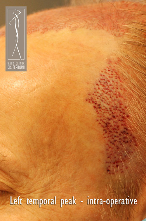 Click image for larger version
Name: DSC_08912.jpg
Size: 79.6 KB
ID: 225