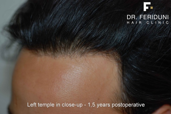 Image uploaded by: Dr Feriduni Hair Clinic