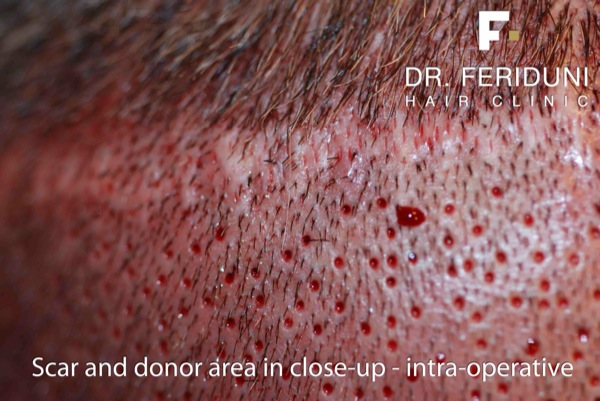 Image uploaded by: Dr Feriduni Hair Clinic