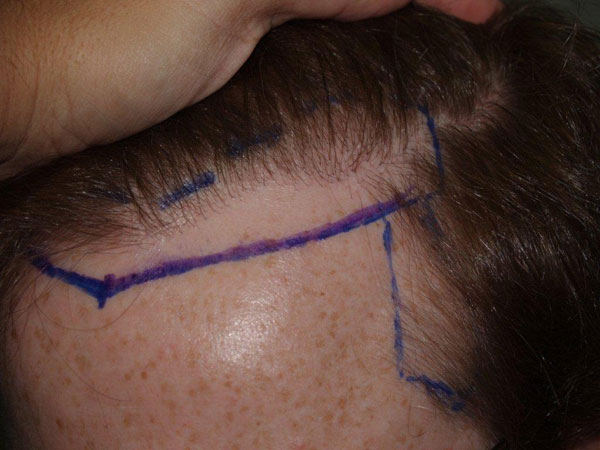 Click image for larger version

Name:	johnmurph-before-hair0.jpg

Size:	51.2 KB
ID:	3124
