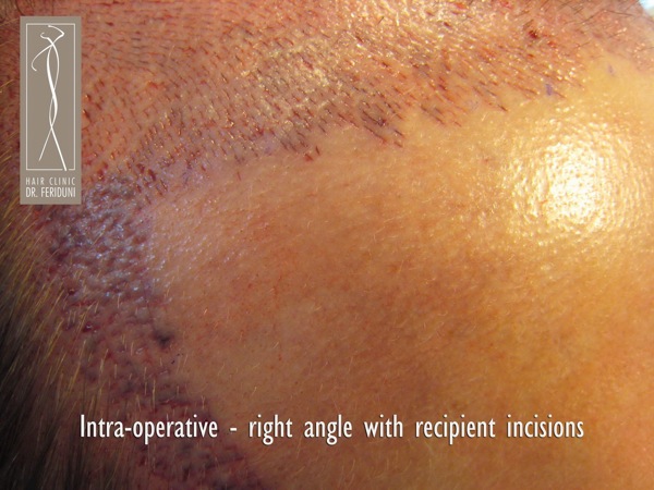 Click image for larger version

Name:	Pic 5.jpg

Size:	92.8 KB
ID:	4923