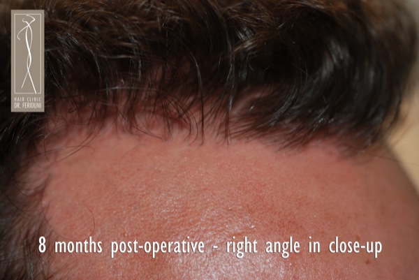 Click image for larger version

Name:	Pic 7.jpg

Size:	67.2 KB
ID:	4925
