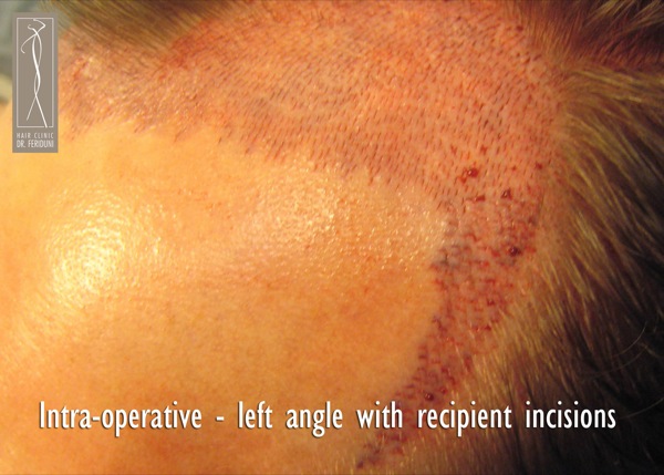 Click image for larger version

Name:	Pic 9.jpg

Size:	83.1 KB
ID:	4927