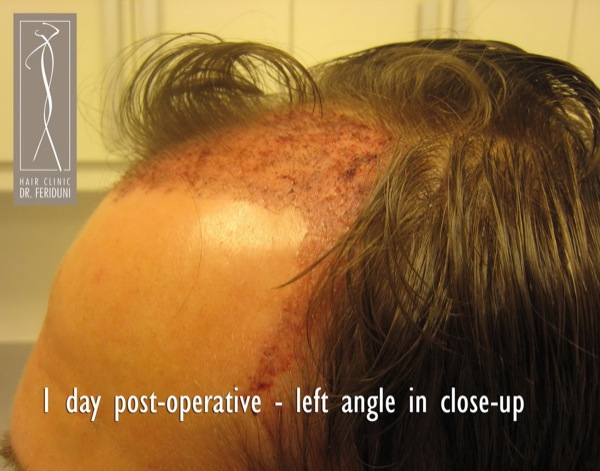 Click image for larger version

Name:	Pic 10.jpg

Size:	84.8 KB
ID:	4928
