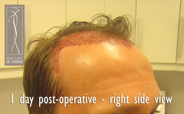 Click image for larger version

Name:	Pic 16.jpg

Size:	63.9 KB
ID:	4934