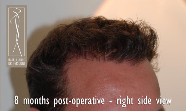 Click image for larger version

Name:	Pic 17.jpg

Size:	54.4 KB
ID:	4935