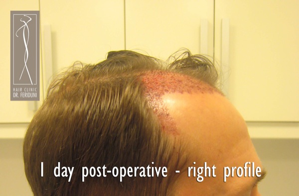 Click image for larger version

Name:	Pic 18.jpg

Size:	59.7 KB
ID:	4936