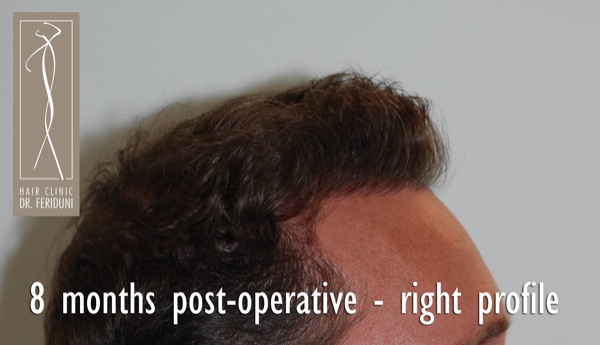Click image for larger version

Name:	Pic 19.jpg

Size:	48.8 KB
ID:	4937