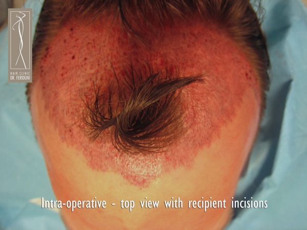 Click image for larger version

Name:	Pic 22.jpg

Size:	69.2 KB
ID:	4940