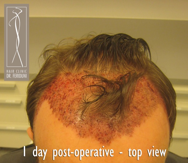 Click image for larger version

Name:	Pic 23.jpg

Size:	85.5 KB
ID:	4941