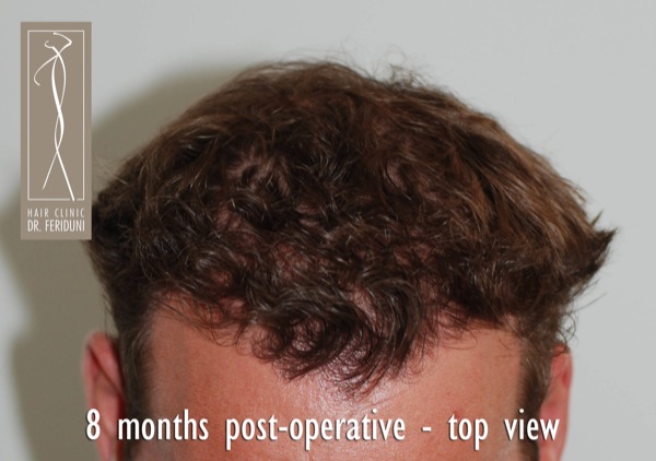 Click image for larger version

Name:	Pic 24.jpg

Size:	64.7 KB
ID:	4942