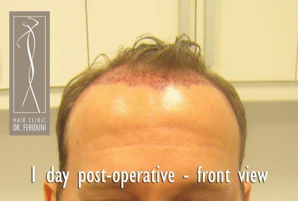 Click image for larger version

Name:	Pic 25.jpg

Size:	54.6 KB
ID:	4943