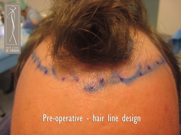 Click image for larger version

Name:	Pic 26.jpg

Size:	72.8 KB
ID:	4944