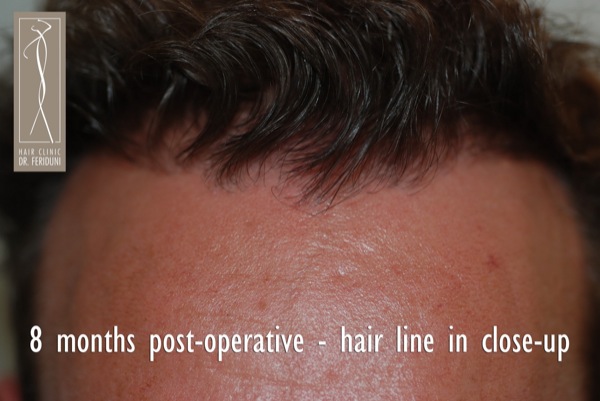 Click image for larger version

Name:	Pic 27.jpg

Size:	66.5 KB
ID:	4945