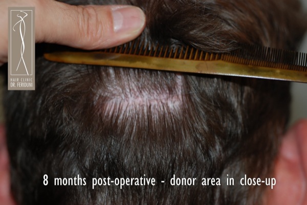 Click image for larger version

Name:	Pic 31.jpg

Size:	71.1 KB
ID:	4949