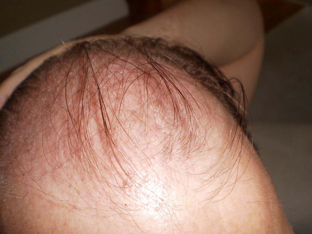 Click image for larger version

Name:	9weeksHead.jpg

Size:	92.1 KB
ID:	5191