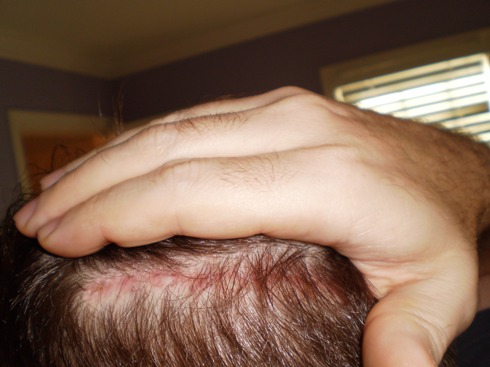 Click image for larger version

Name:	LeftEar.JPG

Size:	54.3 KB
ID:	5193