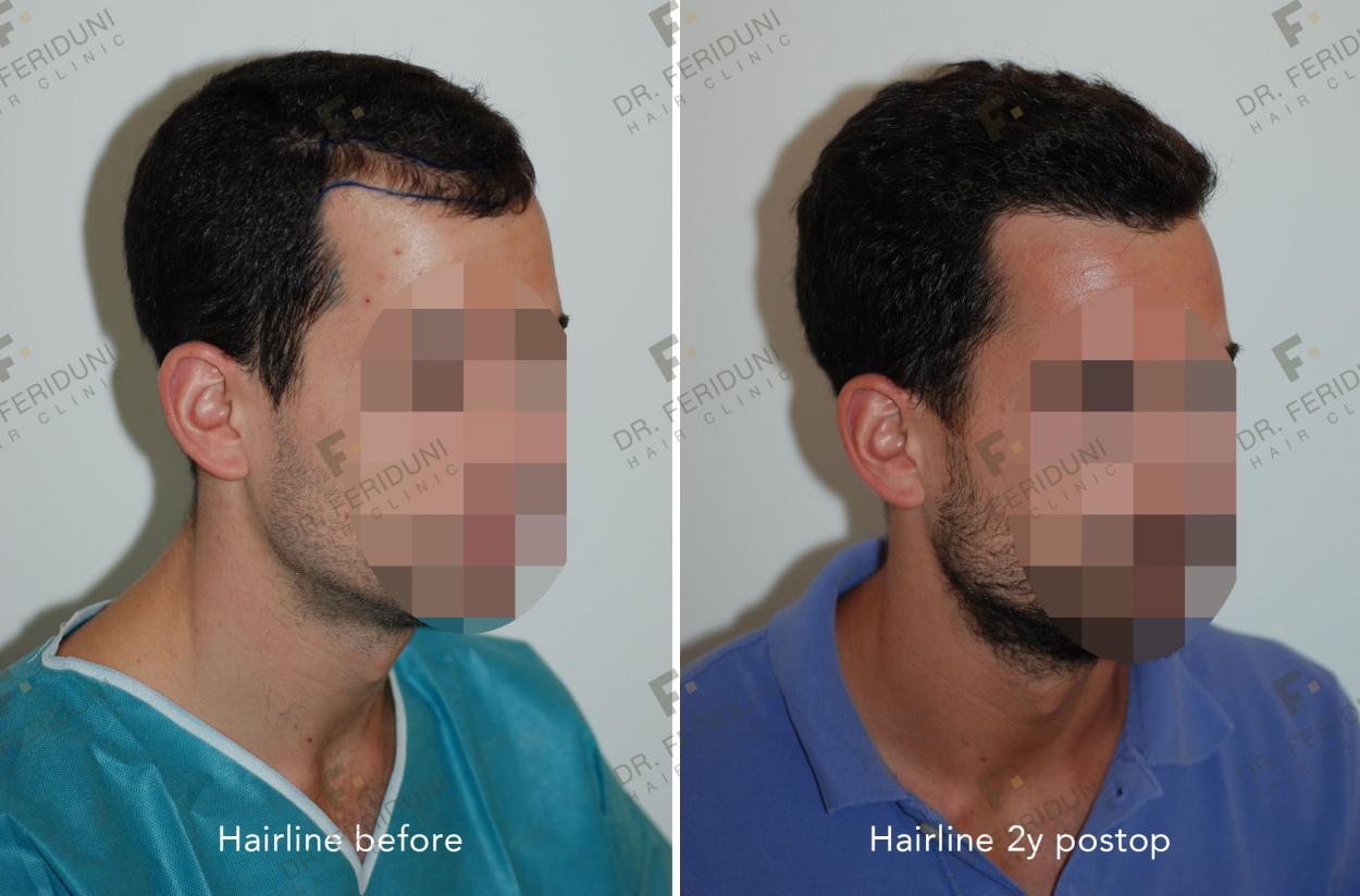 Image uploaded by: Dr Feriduni Hair Clinic