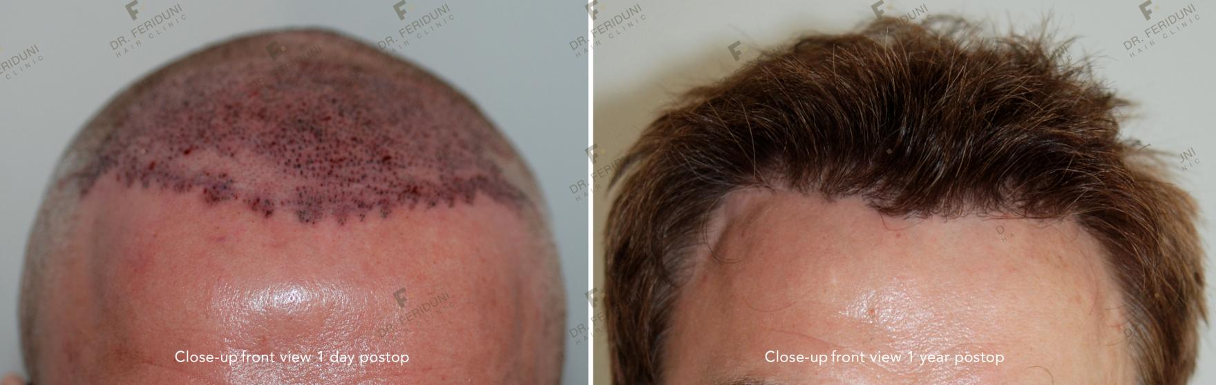 Image uploaded by: Dr Feriduni Hair Clinic