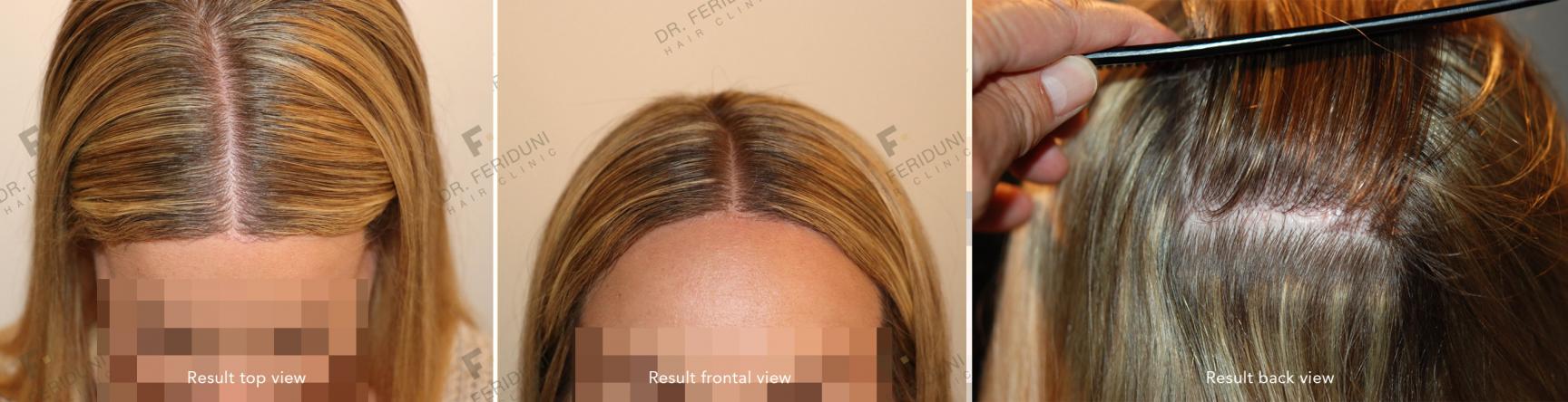 Image uploaded by: Dr Feriduni Hair Clinic