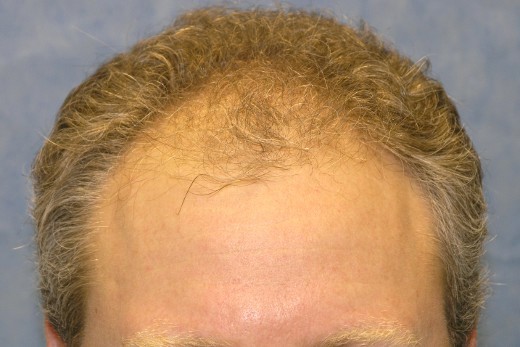 Click image for larger version
Name: 01_before.jpg
Size: 52.0 KB
ID: 7408