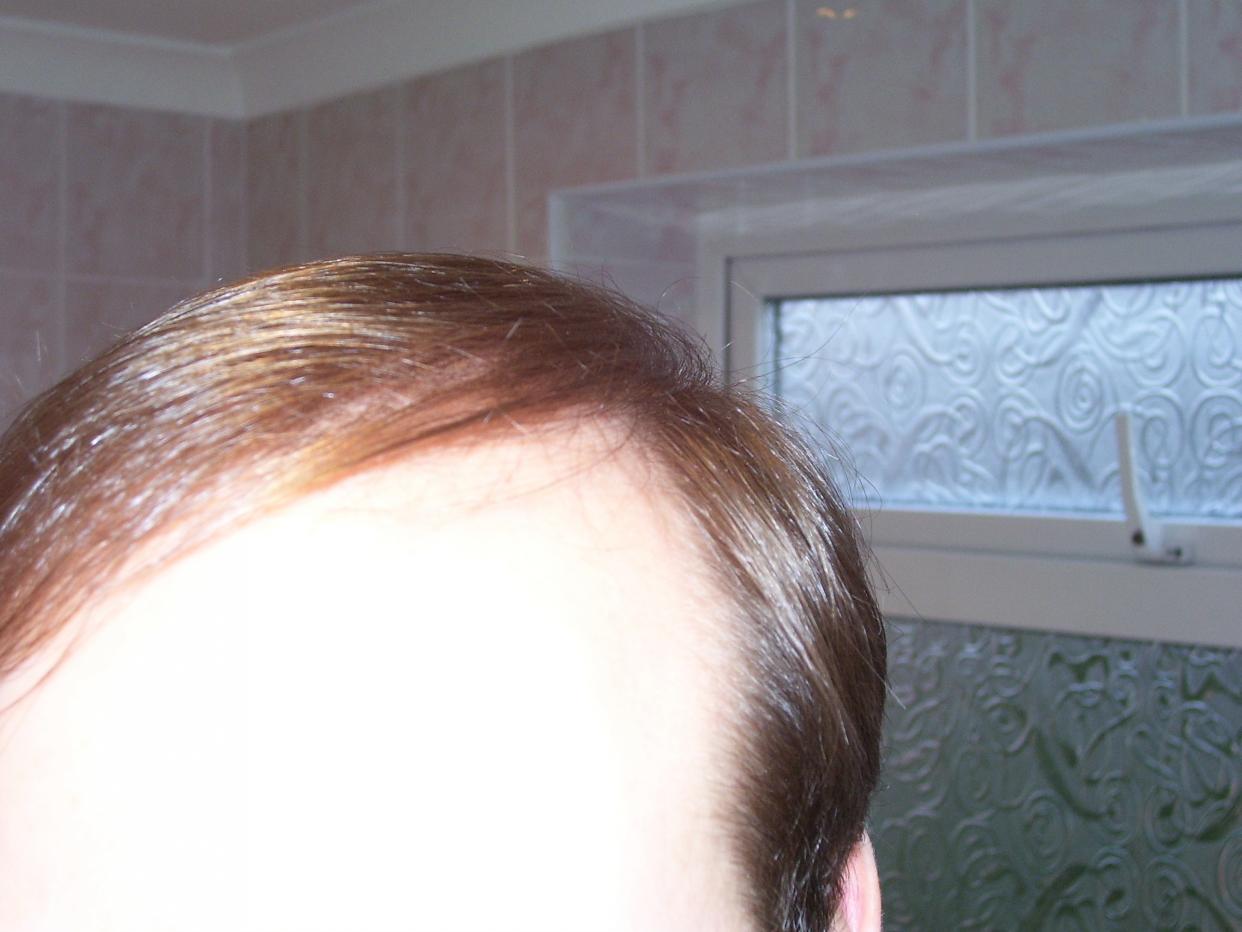 Click image for larger version

Name:	Zoidberg dry hair II at 7 weeks.jpg

Size:	86.2 KB
ID:	8855
