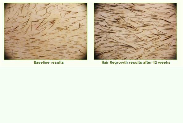 Click image for larger version

Name:	histogen.jpg

Size:	34.9 KB
ID:	9601