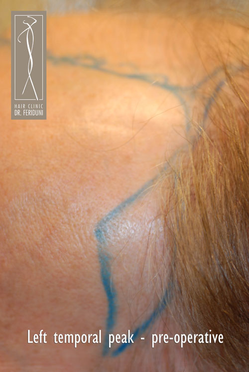 Click image for larger version
Name: DSC_0881.jpg
Size: 60.7 KB
ID: 215