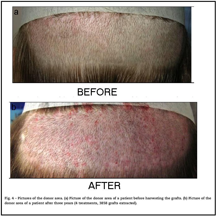 Click image for larger version

Name:	Fig4--Burns 2010--700x700--B--Before After.jpg

Size:	96.2 KB
ID:	9358