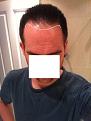 Click image for larger version

Name:	hairline2x.jpg
Views:	897
Size:	30.0 KB
ID:	454463