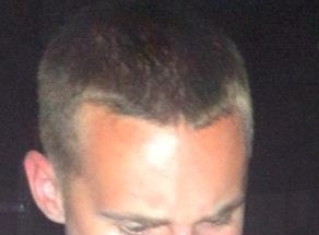 72 Best Why do i have a m shaped hairline for Women