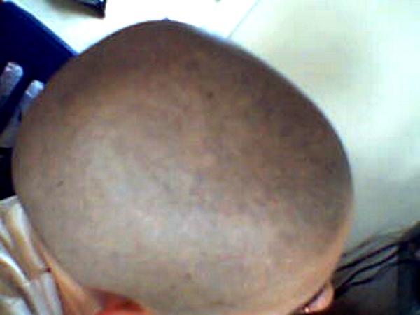 Image uploaded by: AlopecianMuse