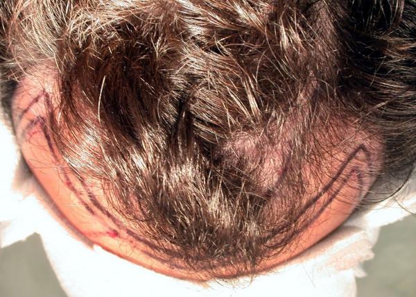 Image uploaded by: Surgassist