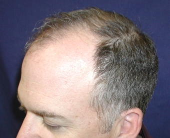 Image uploaded by: Dr. Glenn Charles