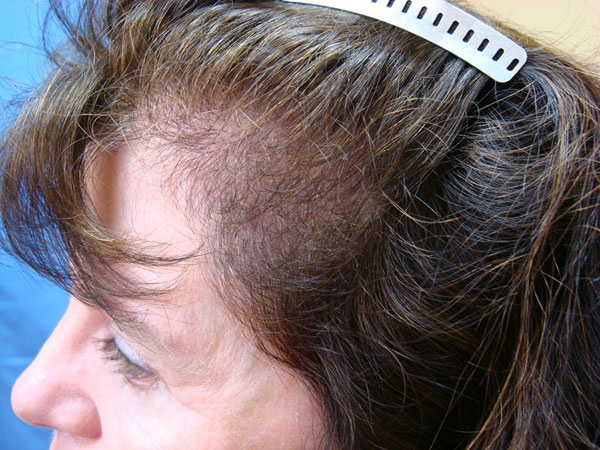 Image uploaded by: Brandon Ross, MD