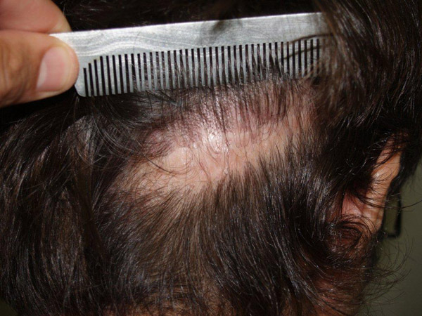 Image uploaded by: Jeffrey Epstein, MD