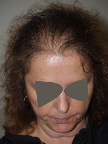 Image uploaded by: Jeffrey Epstein, MD