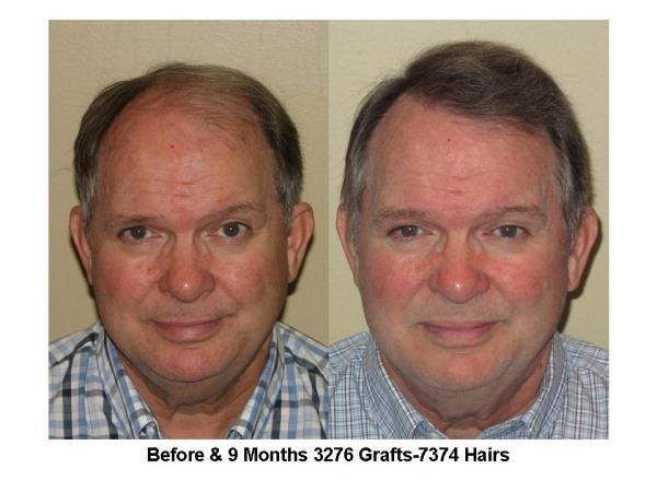 3276/7374, 1 session by Dr. Ron Shapiro