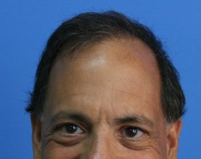 6426 Grafts