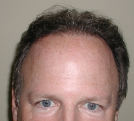 47 Year Old