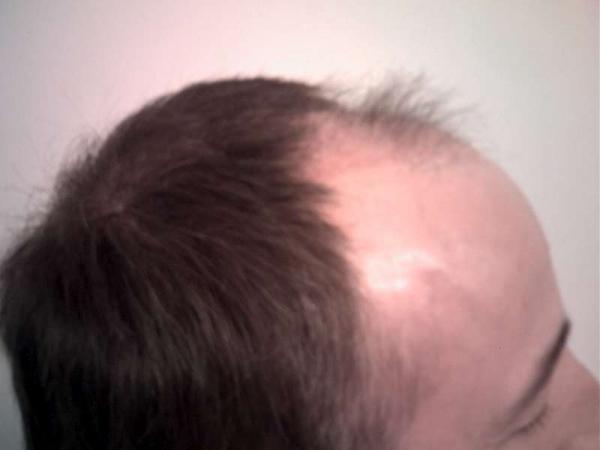 Image uploaded by: Gemini1