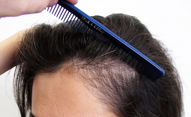 Image uploaded by: Dr. Robert Dorin