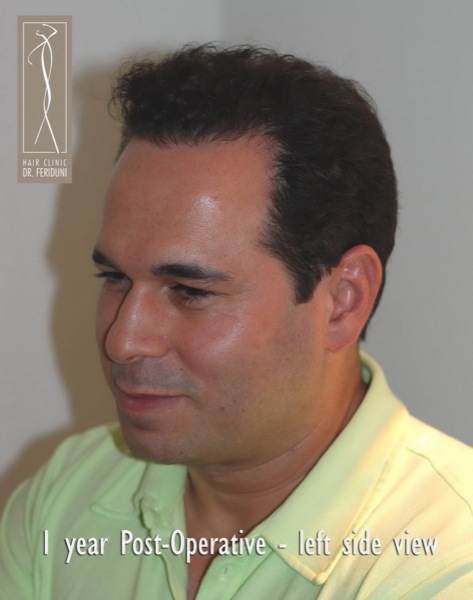 Image uploaded by: Dr Feriduni Hair Clinic